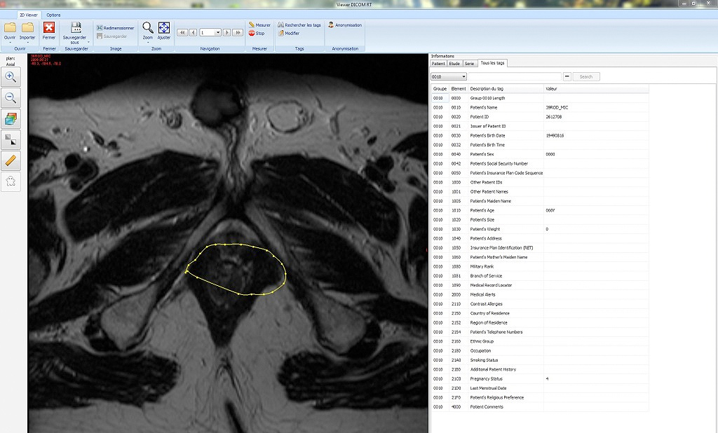 Dicom viewer RT